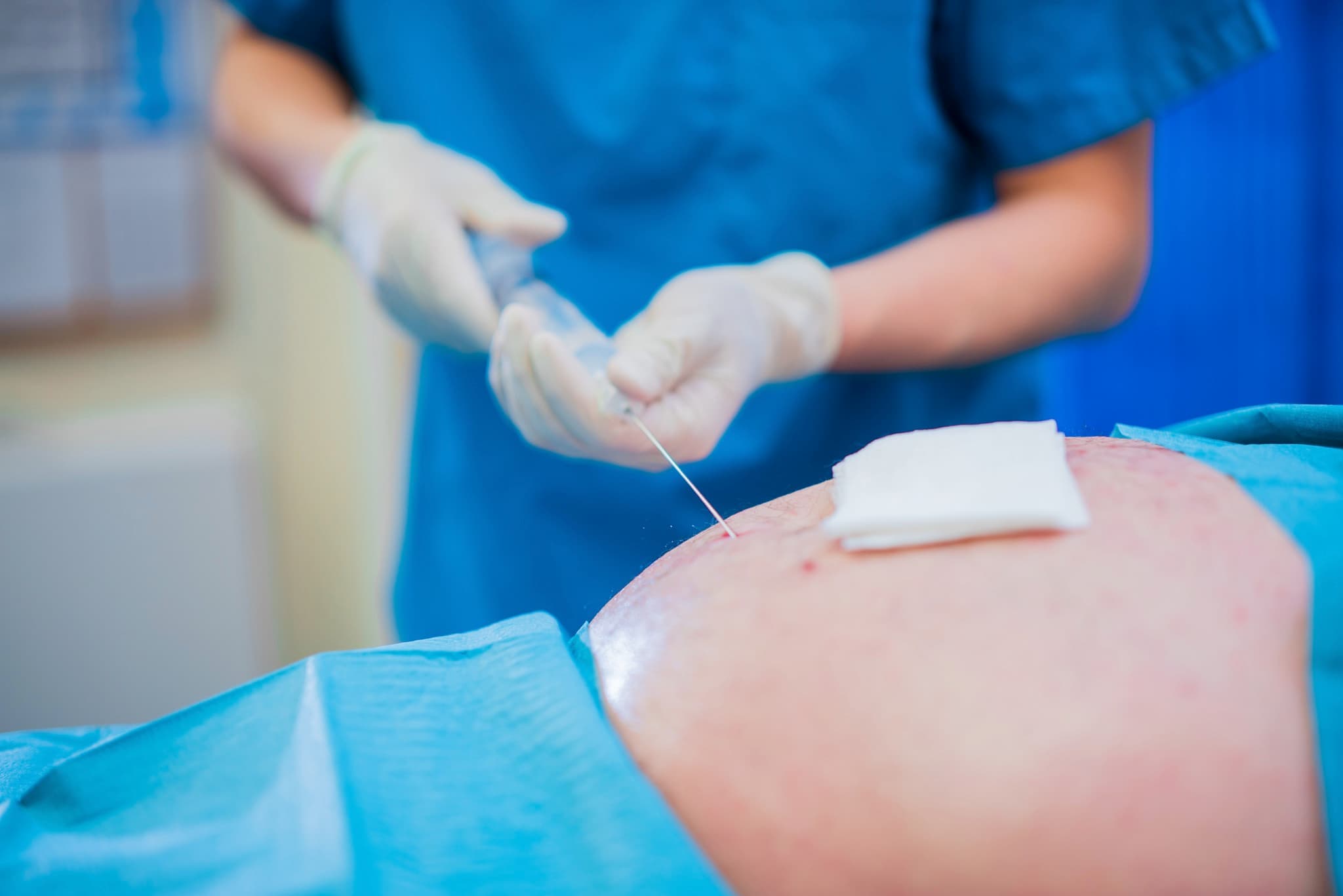 Sterile setup for knee injection preparation