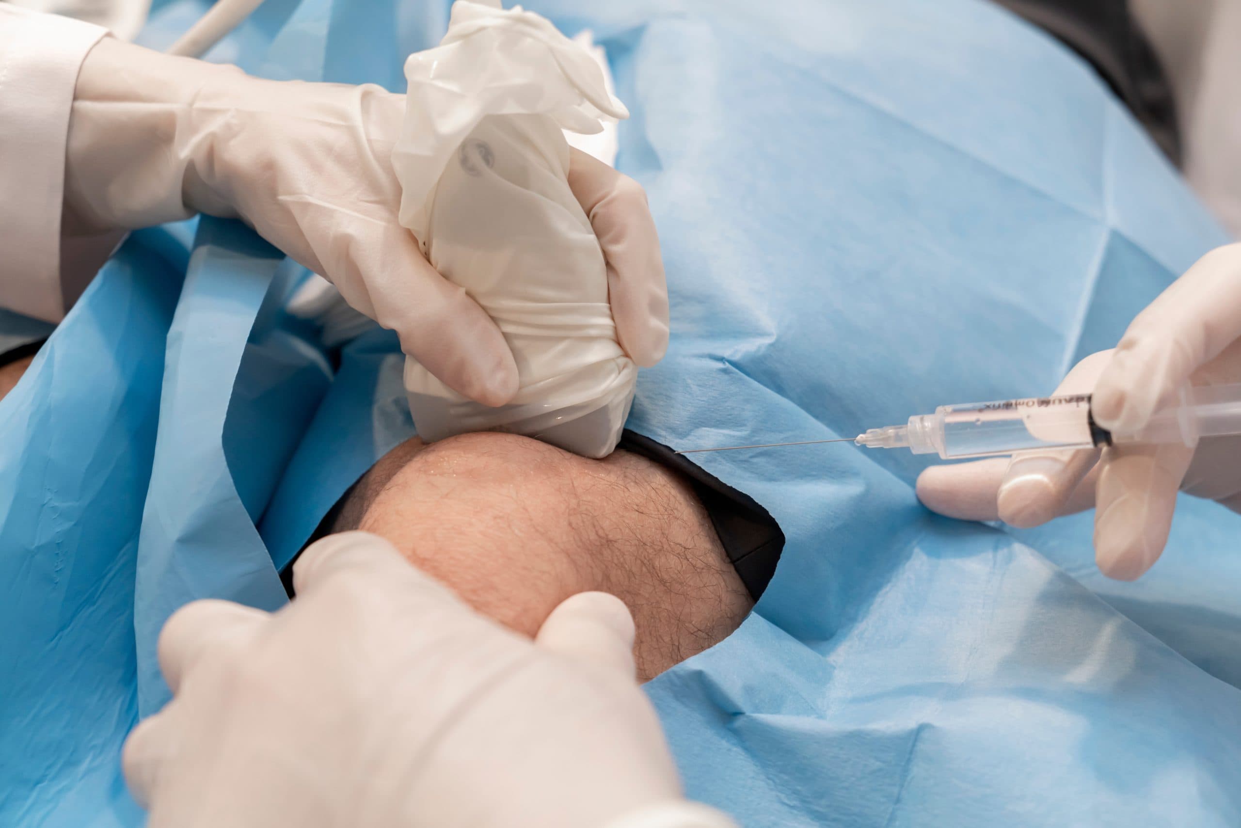 Sterile ultrasound-guided knee injection procedure